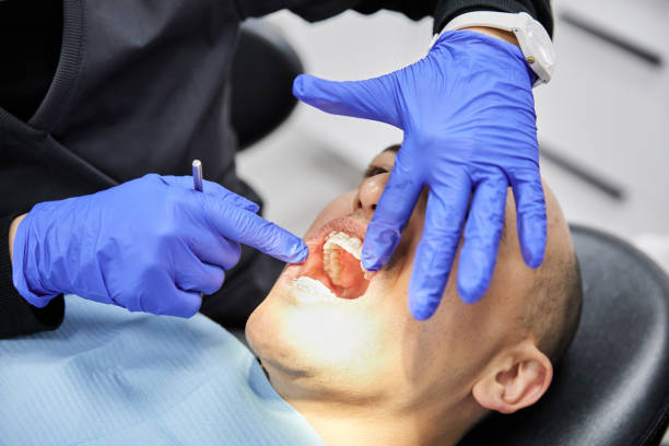 Best Emergency Dentist for Lost Fillings or Crowns in Elgin, SC